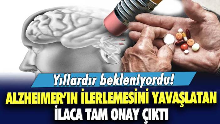 Yıllardır bekleniyordu! Alzheimer’ın ilerlemesini yavaşlatan ilaca tam onay çıktı