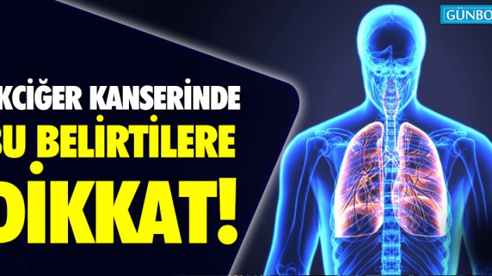 Akciğer kanserinin belirtileri nelerdir?