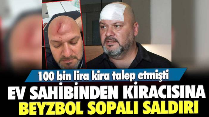 Ev sahibinden kiracısına beyzbol sopalı saldırı! 100 bin lira kira talep etmişti