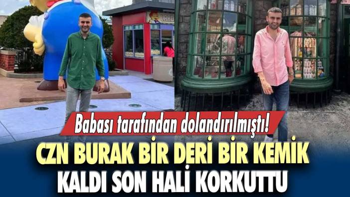 Babası tarafından dolandırılmıştı! Czn Burak bir deri bir kemik kaldı...  Son hali korkuttu