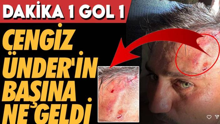 Dakika 1 Gol 1: Cengiz Ünder'in başına ne geldi