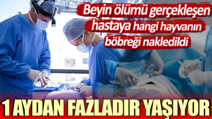 Beyin ölümü gerçekleşen hastaya hangi hayvanın böbreği nakledildi: 1 aydan fazladır yaşıyor