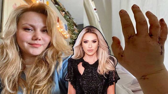 Hadise’den eşinin bıçakladığı Youtuber’a destek!