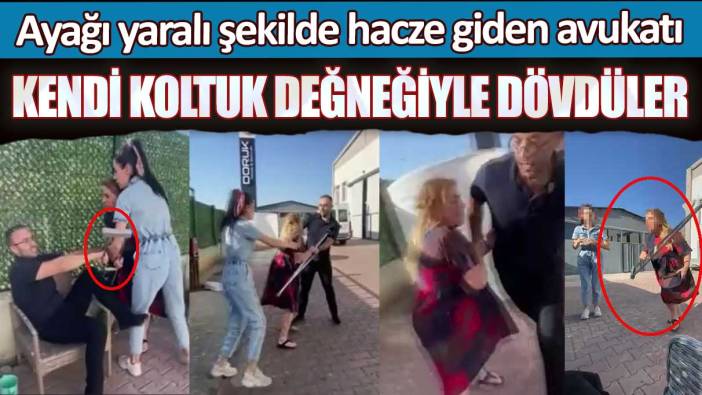 Kayseri’de ayağı yaralı şekilde hacze giden avukatı kendi koltuk değneğiyle dövdüler