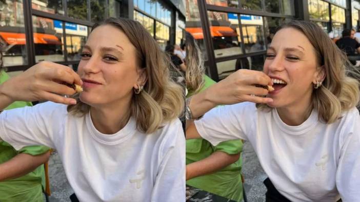 Serenay Sarıkaya'nın yarası hayranlarını korkuttu