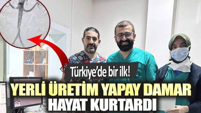 Türkiye’de bir ilk!  Yerli üretim yapay damar hayat kurtardı