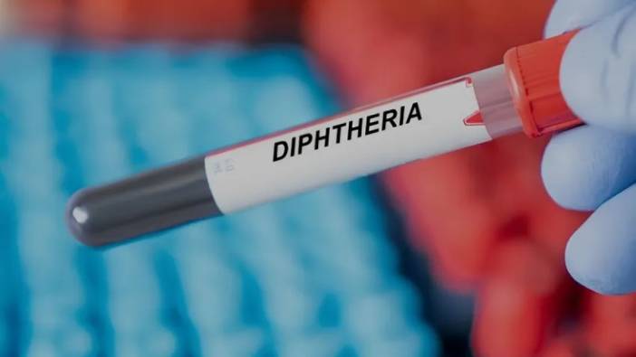 Nijerya'da ikinci difteri dalgası