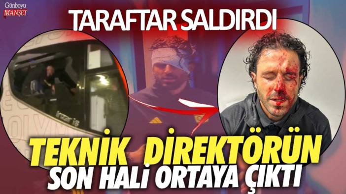 Marsilya taraftarı saldırdı:  Lyon'un teknik direktörü Fabio Grosso'nun son hali ortaya çıktı