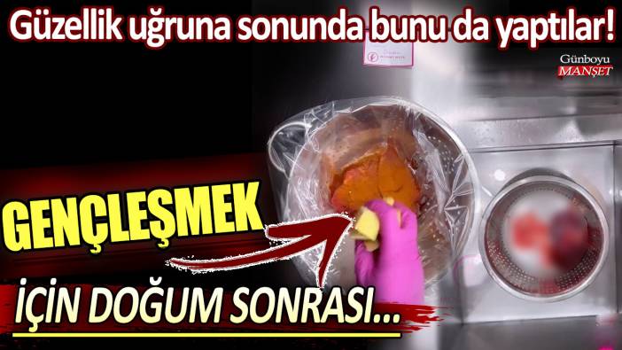 Güzellik uğruna sonunda bunu da yaptılar: Gençleşmek için doğum sonrası...