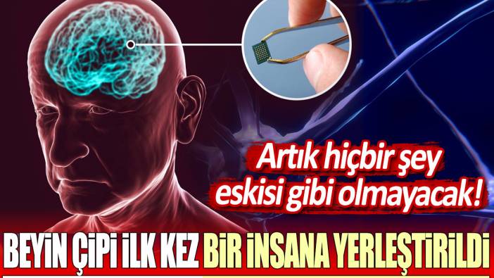 Neuralink beyin çipi ilk kez bir insana yerleştirildi! Artık hiçbir şey eskisi gibi olmayacak...