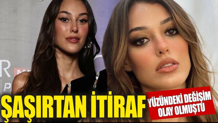 Dilan Çiçek Deniz’den şaşırtan estetik itirafı!