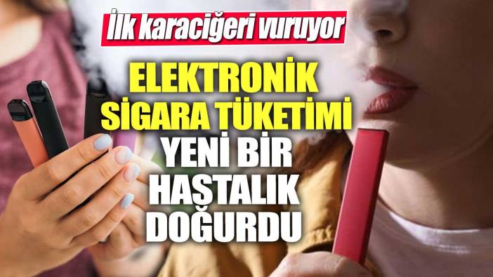 İlk karaciğeri vuruyor! Elektronik sigara tüketimi, yeni bir hastalık doğurdu