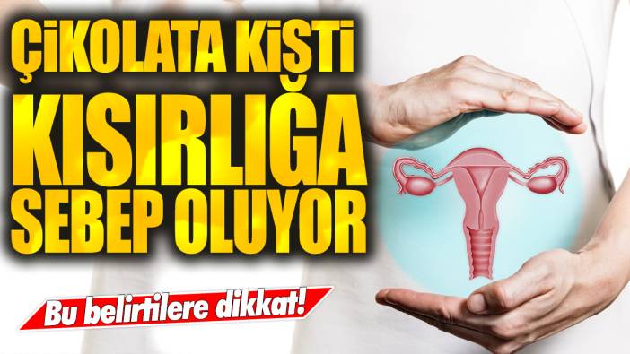 Bu belirtilere dikkat: Çikolata kisti kısırlığa neden oluyor!