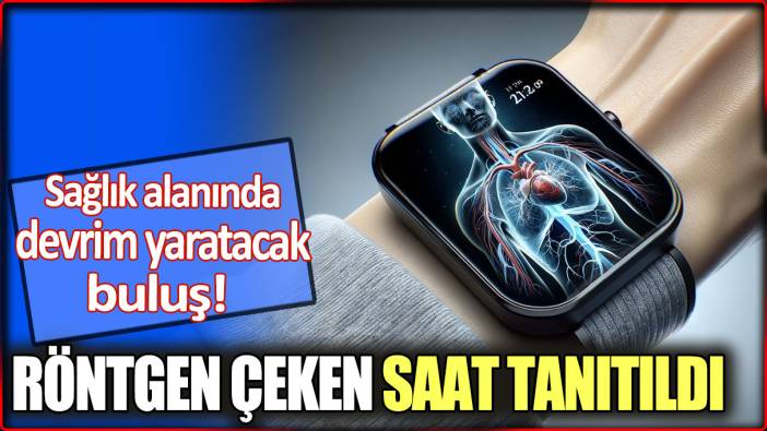 Röntgen çeken saat tanıtıldı: Sağlık alanında devrim yaratacak buluş!