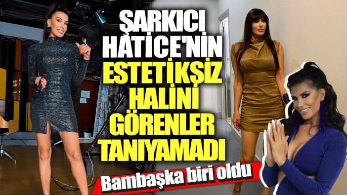 Şarkıcı Hatice'nin estetiksiz halini görenler tanıyamadı! Bambaşka biri oldu