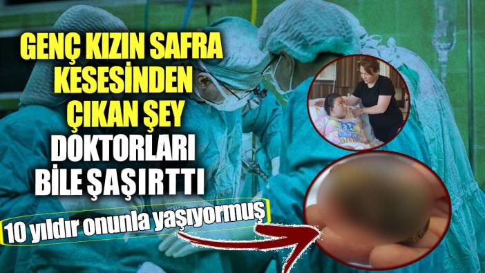 10 yıldır onunla yaşıyormuş! Genç kızın safra kesesinden çıkan şey doktorları bile şaşırttı