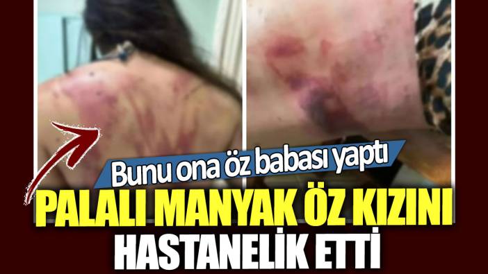 Bunu ona öz babası yaptı! Palayla öz kızını hastanelik etti