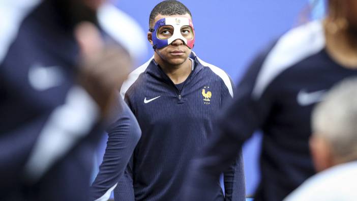 Burnu kırılan Mbappe'nin son hali ortaya çıktı