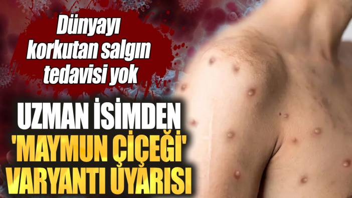 Uzman isimden 'maymun çiçeği' varyantı uyarısı! Dünyayı korkutan salgın tedavisi yok