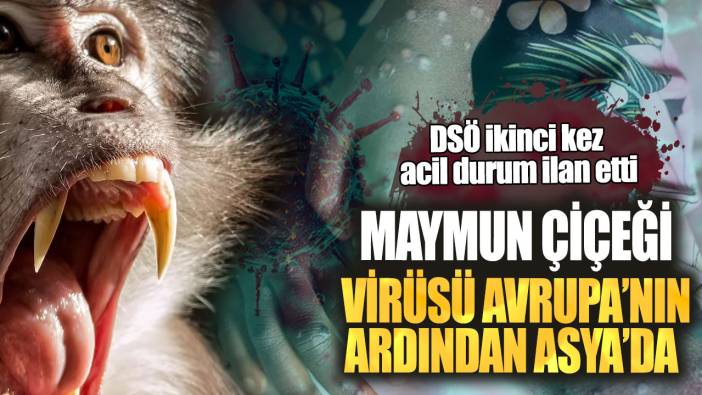 DSÖ ikinci kez acil durum ilan etti! Maymun çiçeği virüsü Avrupa’nın ardından Asya'da