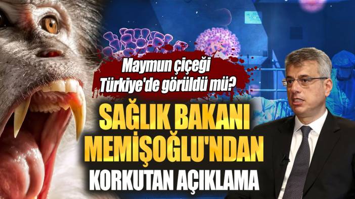 Sağlık Bakanı Memişoğlu'ndan korkutan açıklama! Maymun çiçeği Türkiye'de görüldü mü?