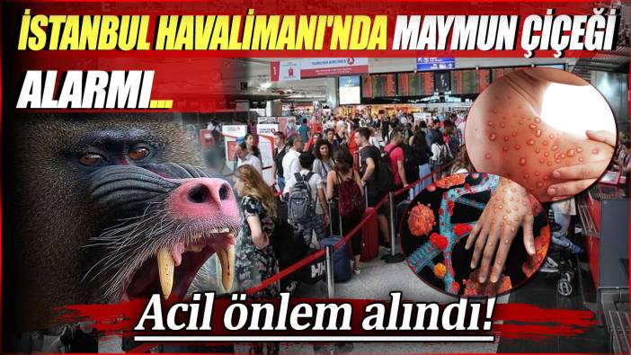 İstanbul Havalimanı'nda maymun çiçeği alarmı. Acil önlem alındı!