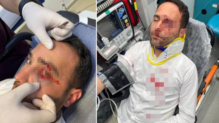 Sinir krizi geçirdi! Komşusu olan imamı telle boğmaya çalıştı