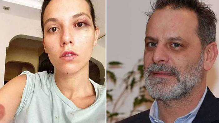 Ozan Güven için 11 yıl 6 ay hapis cezası talebi: Eski sevgiliye darp davasında yeni gelişme