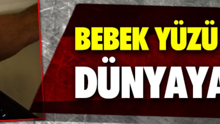 Bebek yüzü olmadan dünyaya geldi! Doktor açığa alındı