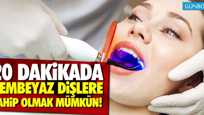 20 dakikada bembeyaz dişlere sahip olmak mümkün!