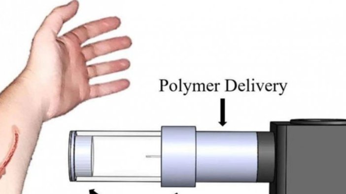 Bilim insanları sprey şeklinde bandaj üretti!