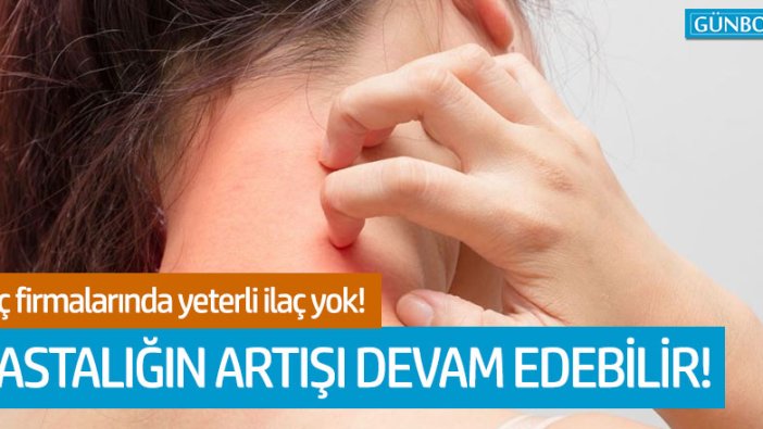 Uyuz hastalığının artışı devam edebilir!