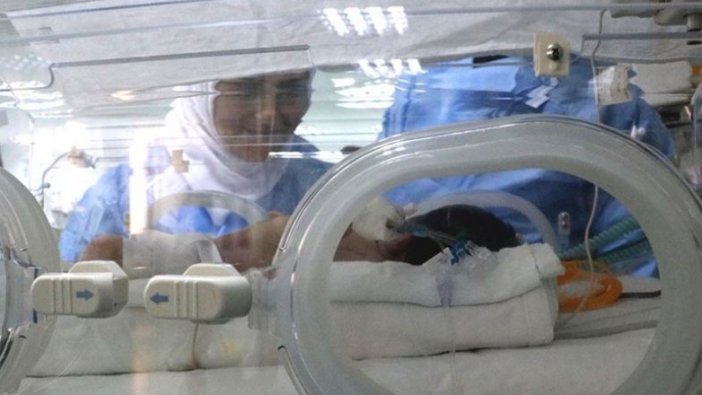 Mide ve bağırsakları dışarıda doğdu!