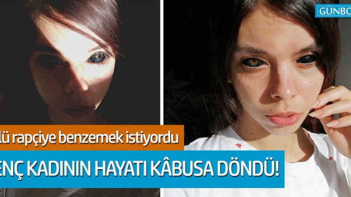 Ünlü rapçiye benzemek isterken hayatı karardı!