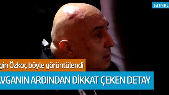Engin Özkoç'un kafasında ve yüzünde şişlik oluştu