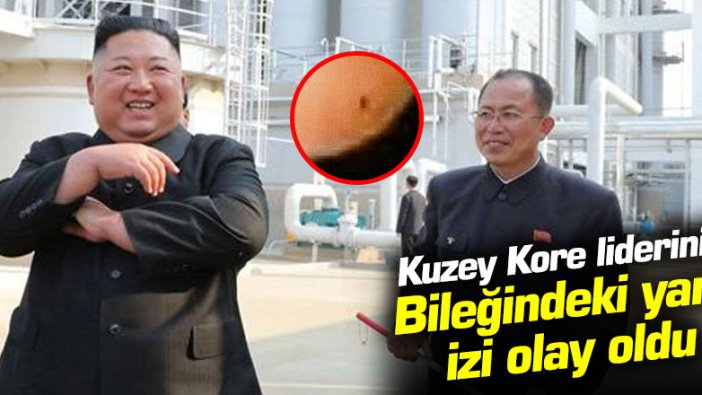 Kuzey Kore lideri Kim'in bileğindeki yara izi olay oldu