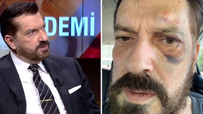 Hakan Bayrakçı uğradığı saldırıyı böyle anlattı: Yiyorsa tek gel dedim