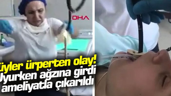 Tüyler ürperten olay! Uyurken ağzına girdi, ameliyatla çıkarıldı