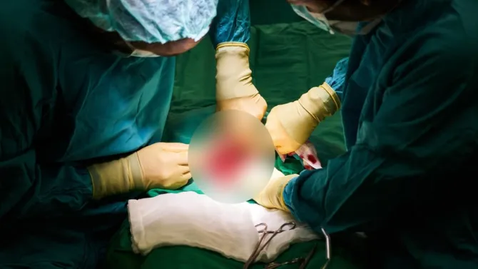 surgery-3034076-1920-omdq-cover.webp